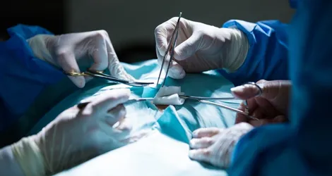 Appendix Cancer Treatment Appendectomy Image