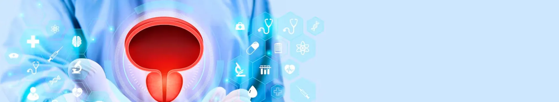 Bladder Cancer Image