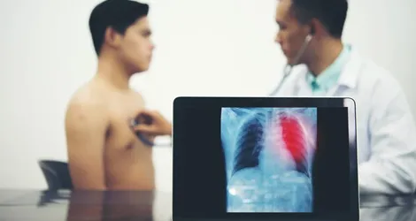 Targeted Therapy Image