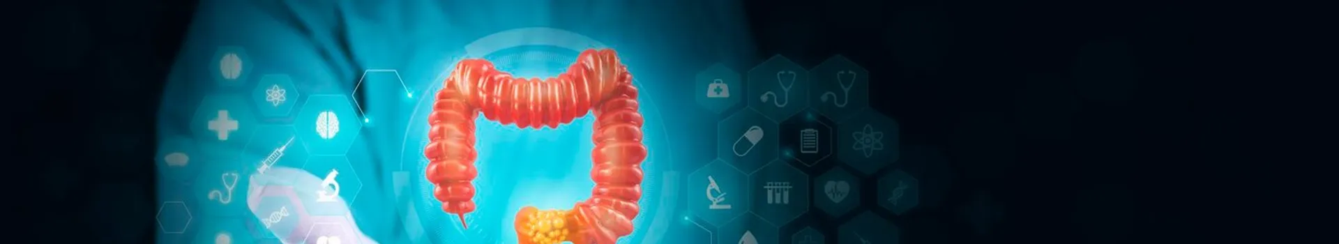 colon cancer symptoms, causes, diagnosis, treatment