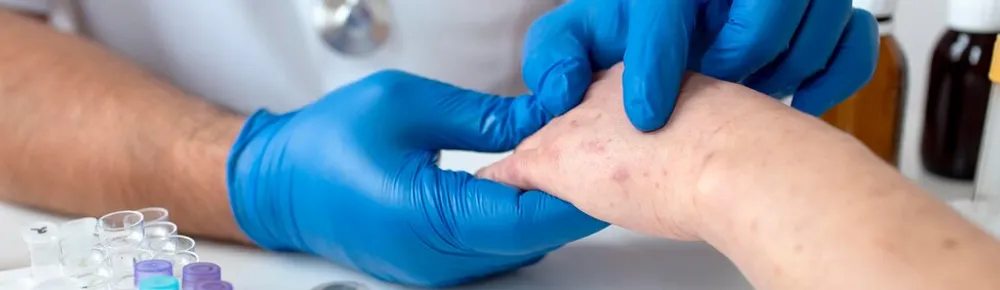 Sarcoma Cancer Image