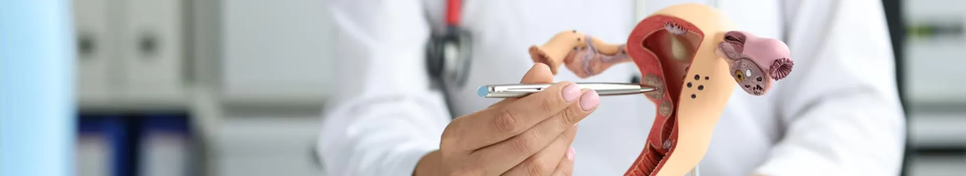 Uterine or Endometrial Cancer